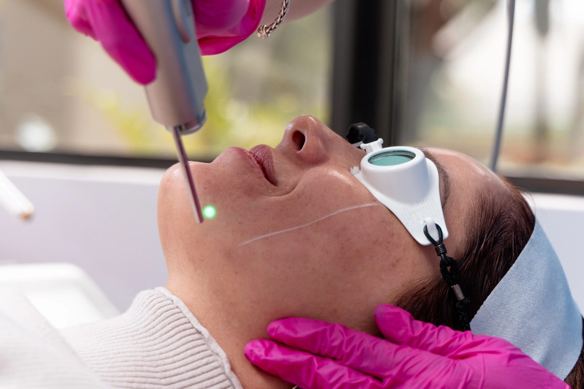 Tratamiento láser facial Fotona en Ageless Perfection Miami