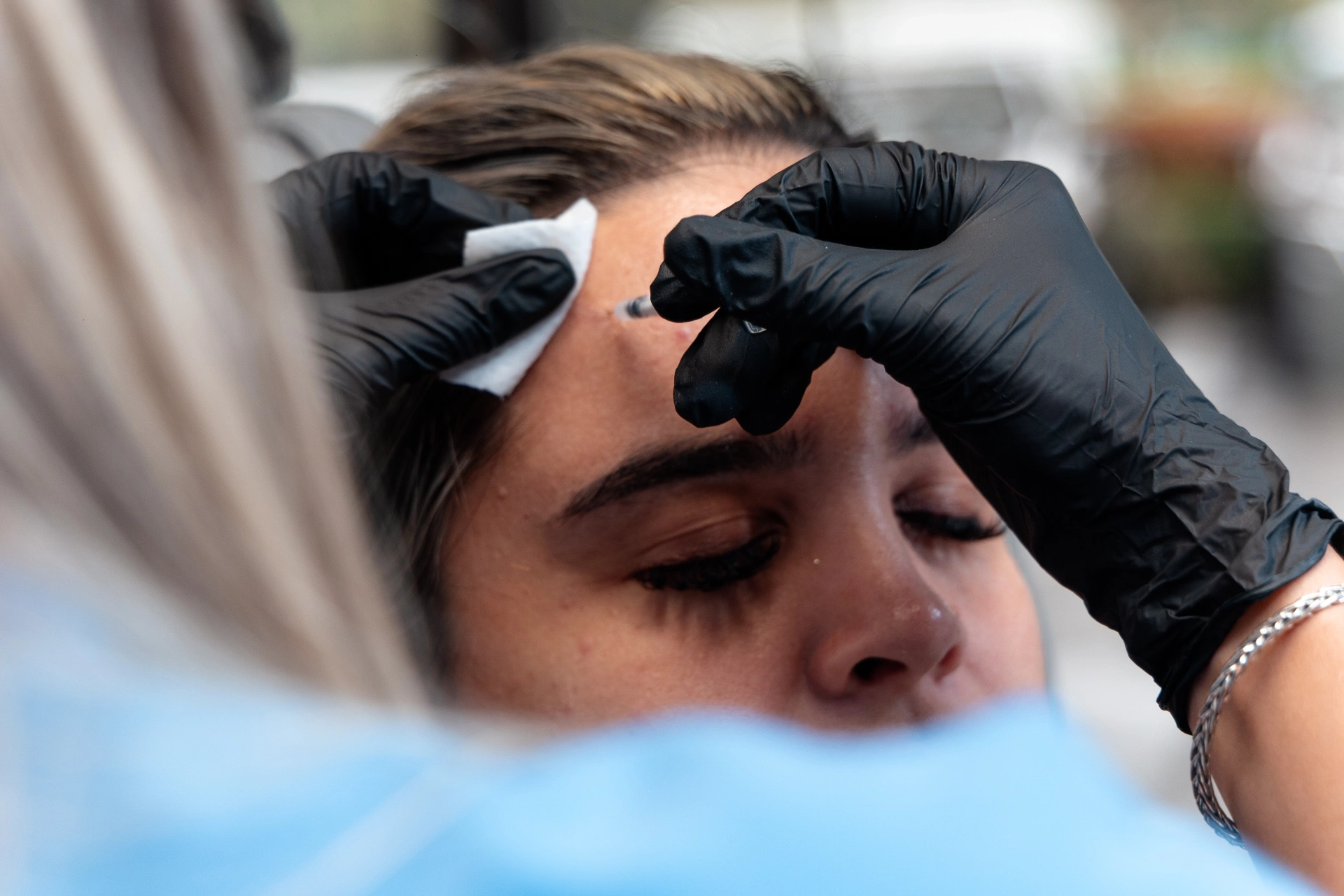 Aplicación de Botox en la frente en Ageless Perfection Miami
